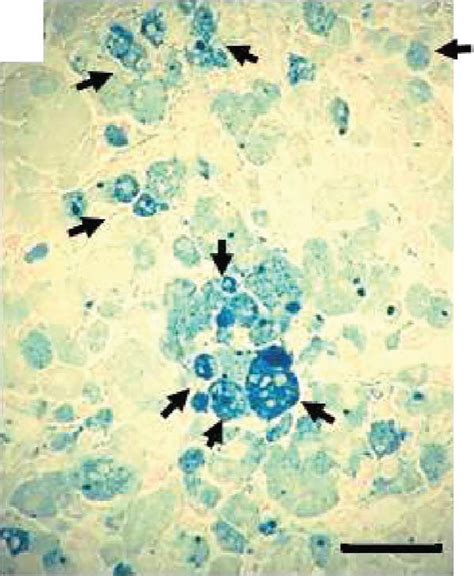 Hemosiderin In The Aged C56bl6 Ovary He Stain A B And Perls Stain