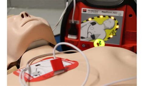 Citizen Responder Cpr And Defibrillation Programs May Improve Survival