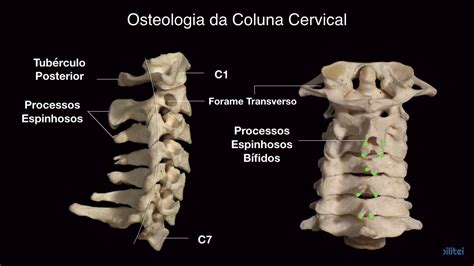 Anatomia Da Coluna Cervical Youtube