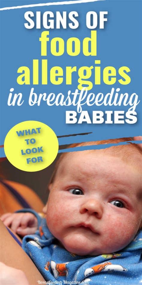 Food Allergies In Babies Who Breastfeed Common Signs And Solutions