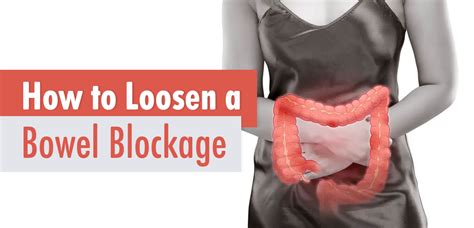 How To Loosen A Bowel Blockage Life Infused How To Loosen A Bowel Blockage