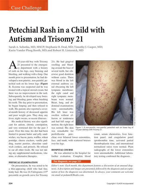 Pdf Petechial Rash In A Child With Autism And Trisomy 21