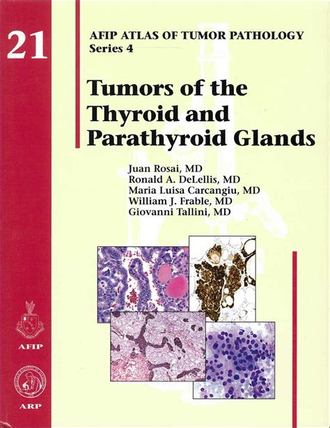 Atlas Of Tumor Pathology 4th Series Fascicle 21 Tumors Of The