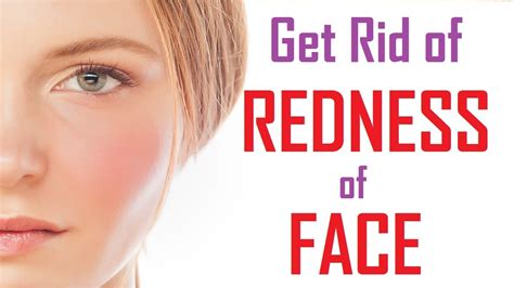 Top 15 Ways To Reduce Face Redness How To Get Rid Of Redness On Face Youtube