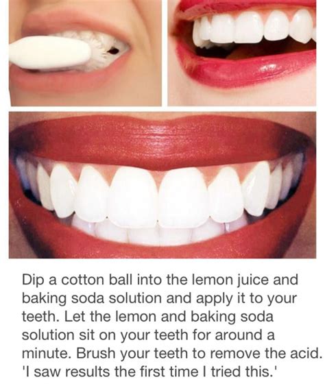 List Pictures How To Whiten Teeth In Photos Sharp