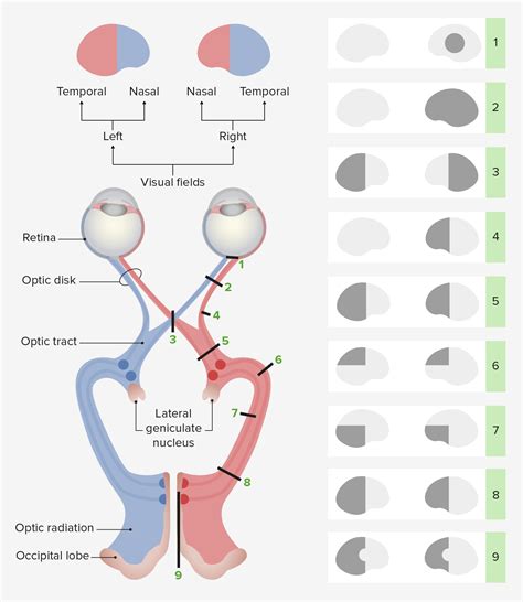 Visual Pathway And Visual Field Defects Lecturio Medical