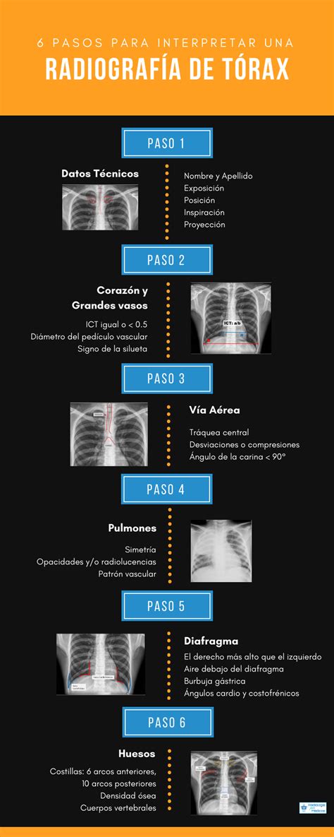 Pin en Radiología de Tórax