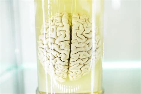 Human Brain In A Jar Real Specimen Stock Image Image Of Scientific