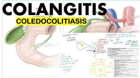 COLANGITIS ETIOLOGÍA FISIOPATOLOGÍA DIAGNÓSTICO Y TRATAMIENTO