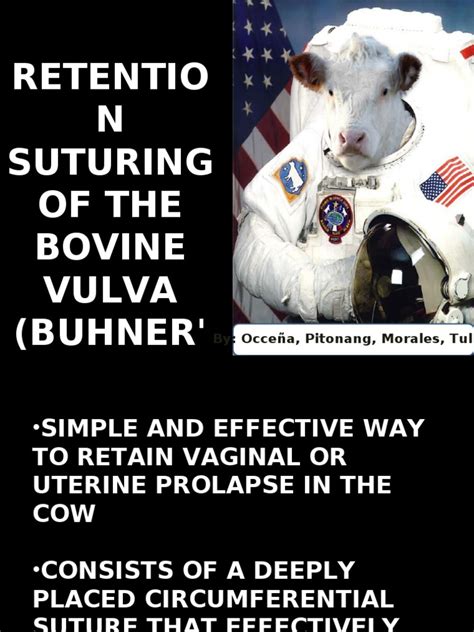Buhner Method Pdf Surgical Suture Vagina
