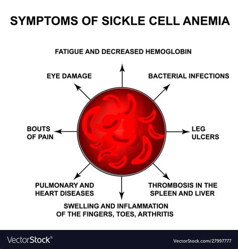 Describe The Symptoms Of Sickle Cell Anemia Harrykruwperez