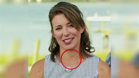 What does throat cancer look like? Woman diagnosed with cancer after HGTV appearance 'forever ...
