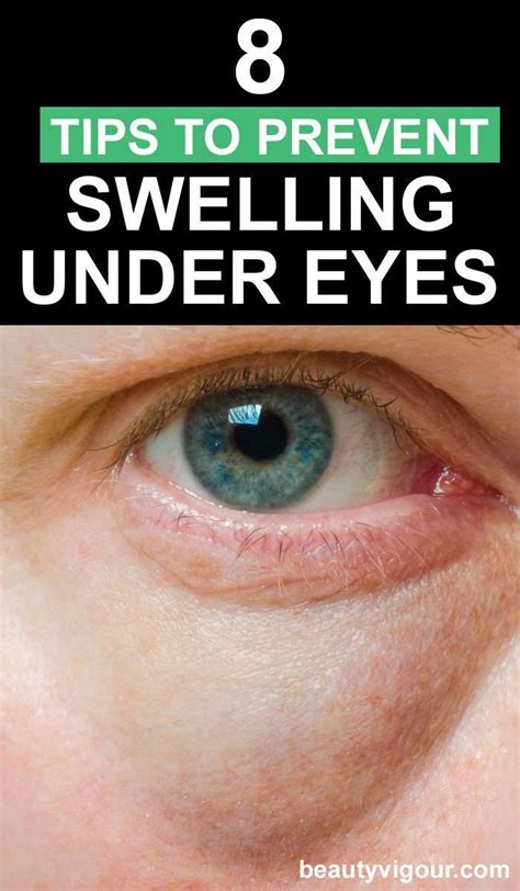 8 Tips To Prevent Swelling Under Eye Prevent Swelling Undereye