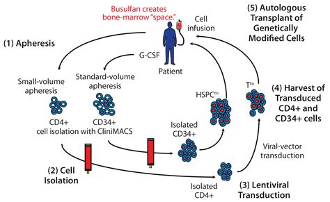 Cell-Delivered Gene Therapy: This Viral Vector Manufacturing Method