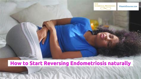 How To Start Reversing Endometriosis Naturally The Vanessa Protocol