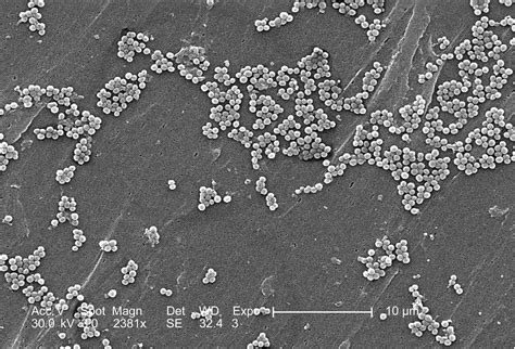 Imagem Gratuita Estirpe Staphylococcus Aureus Bact Rias Vancomicina