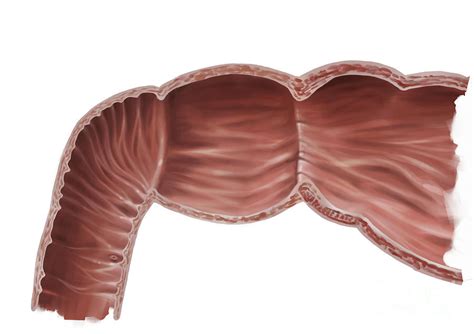 Duodenum And Pylorus Photograph By Medical Graphicsmichael Hoffmann