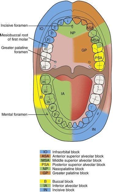 Local Anesthetic Blocks And The Structures Anesthetized Dentaltown