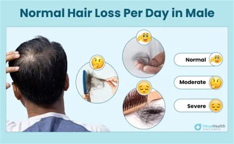 What Is The Normal Amount Of Hair Loss Per Day In Males