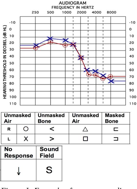 Figure 2 From Guide To Audiology And Hearing Aids For Otolaryngologists