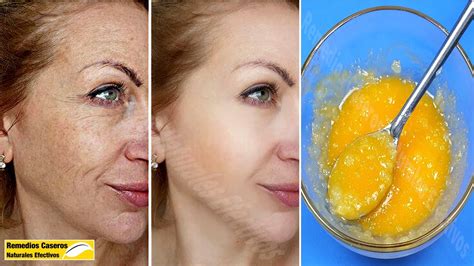 Eliminar Las Arrugas En Sólo 7 Días Sólo Con Una Crema Casera Que Te