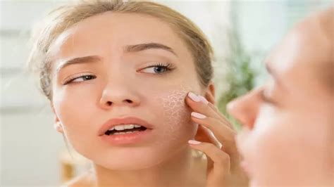 5 Mistakes That Can Cause Dry Skin Problem In Summer Know Dry Skin
