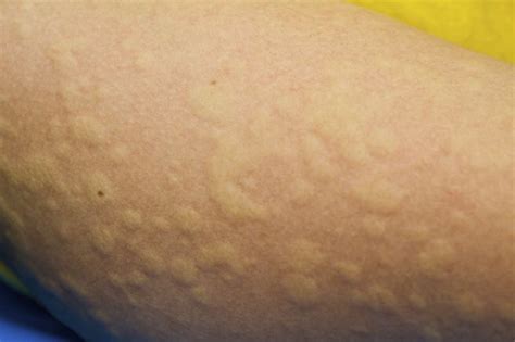 Rezepte und reiseziele in norddeutschland, gesundheitsthemen und ideen für gartenfreunde sowie nützliche verbrauchertipps. Haut+Haare - Das Medizin Blog