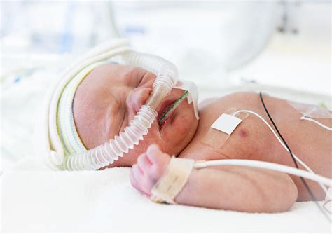 Ventilação Não Invasiva Neonatal Neoup Ead