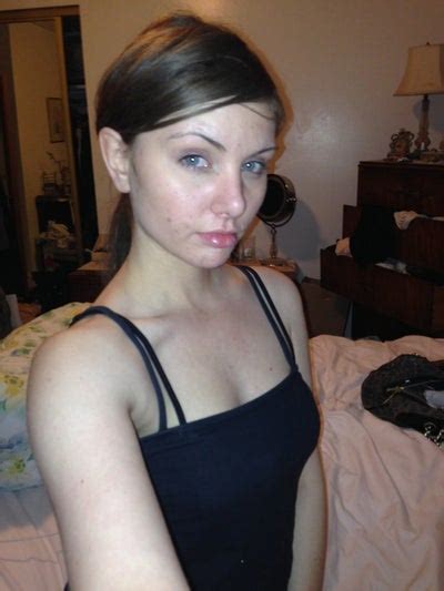 How much does buccal fat removal cost? Would buccal fat removal improve my appearance ...