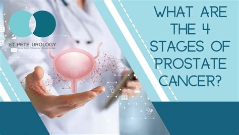 Forgotten Facts About Prostate Cancer St Pete Urology