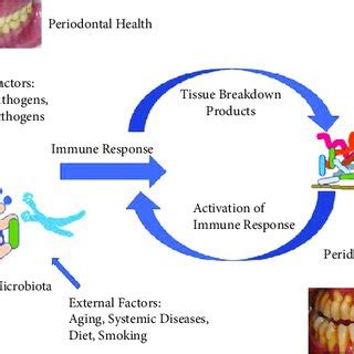 Pathogenesis In Periodontitis And Immune Response On Dysbiosis Download Scientific Diagram