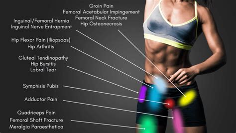 Hip Pain Location Diagram Hip Pain Chart