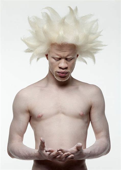 Pin On Albino Men