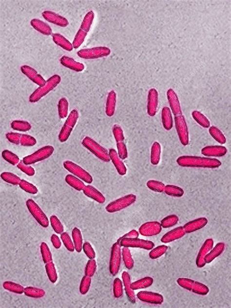 Listeria Monocytogenes Bacteria Lm Stock Image C0282778 Science