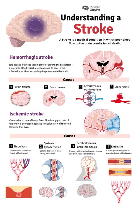 A stroke happens when blood flow to your brain is interrupted. Stroke symptoms and risk factors — Mind The Graph | by ...