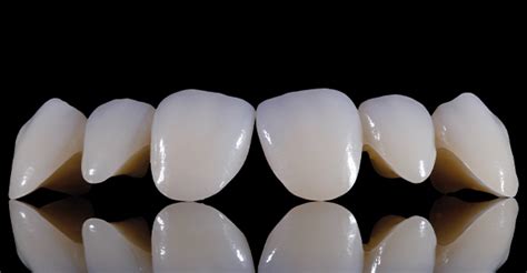 Prettau Zirconia From Zirkonzahn