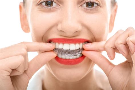 Invisalign Vs Regular Braces Which One Is Best For You