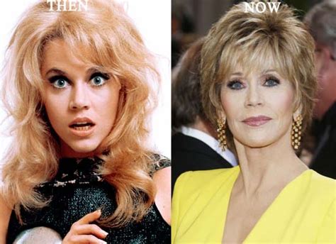 Jane Fonda Plastic Surgery Before and After Photos ...