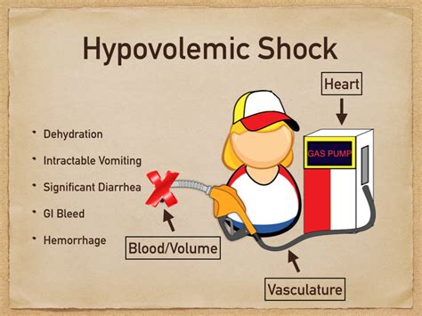 Types Of Shock Cardiogenic Vs Hypovolemic Vs Obstructive Vs