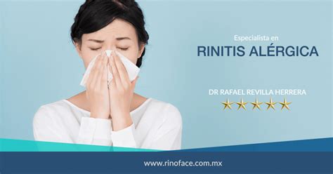 Rinitis Alérgica Dr Rafael Revilla