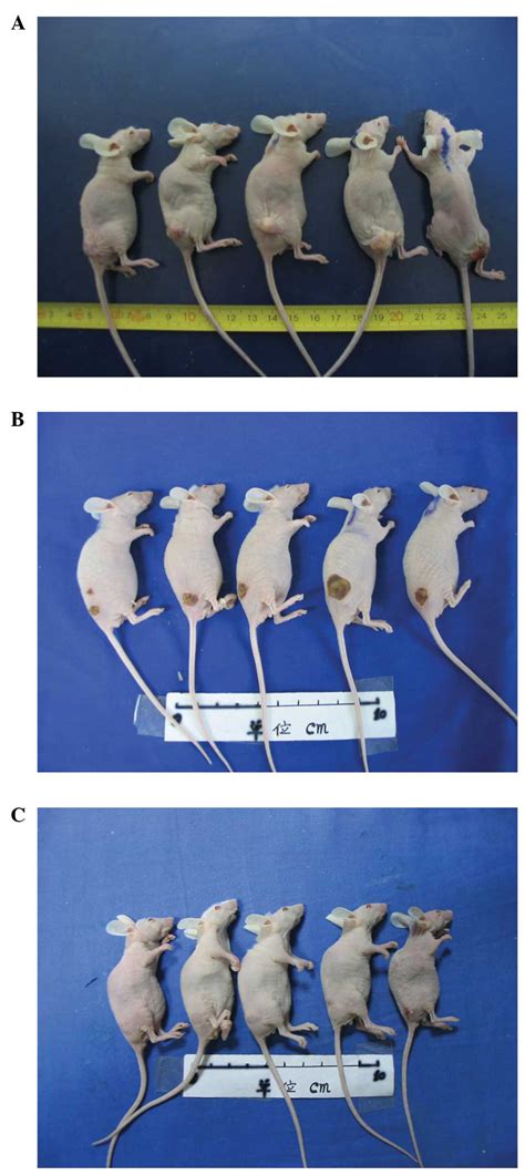 Treatment Of Pancreatic Cancer In A Nude Mouse Model Using High Intensity Focused Ultrasound