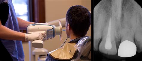 Digital X Rays Laurel Billings Mt Dental Services