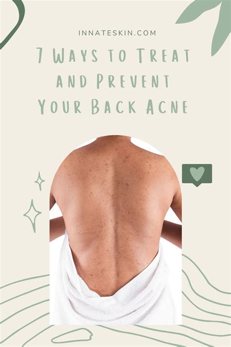7 Ways To Treat And Prevent Your Back Acne In 2021 Acne Causes Diy
