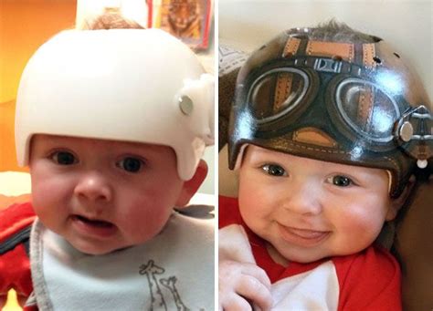 Artist Transforms Babies Head Shaping Helmets Into Beautiful Art