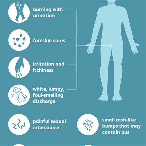 male yeast infection causes and symptoms