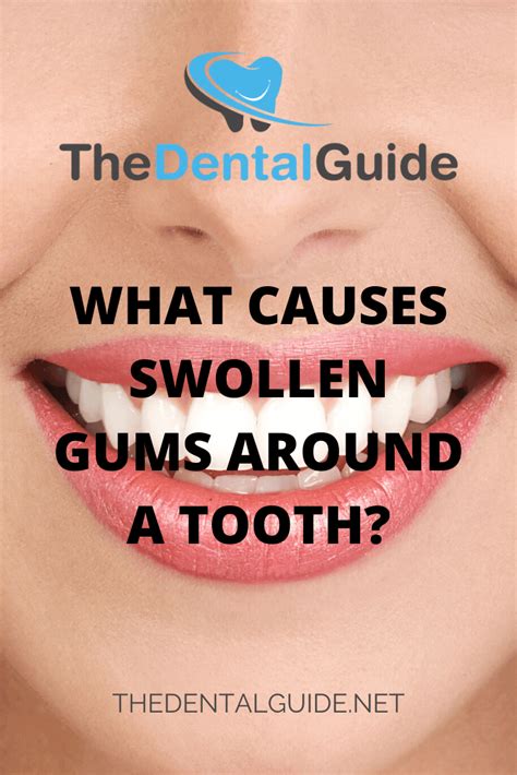 What Causes Swollen Gums Around A Tooth The Dental Guide