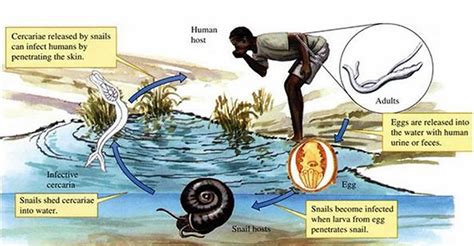 Schistosomiasis Causes Symptoms Diagnosis Prevention Andandtreatment