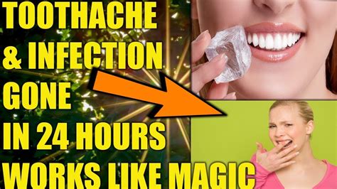 Home Remedies For Tooth Infection Severe Toothache Remedy How To