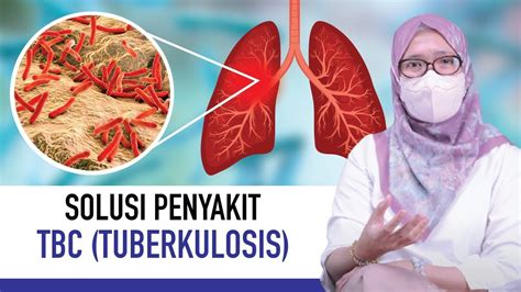 Apa Itu Penyakit Tuberkulosis Yuk Kenali Gejala Penyebab Dan Cara