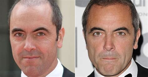 Check out the release date, story, cast and crew of all upcoming movies of james nesbitt at filmibeat. James Nesbitt Credits Hair Transplant With Boosting His ...